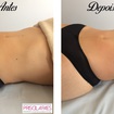 #priscilapaesesteticista #esteticacorporal #massagemmodeladora