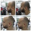 BARBA