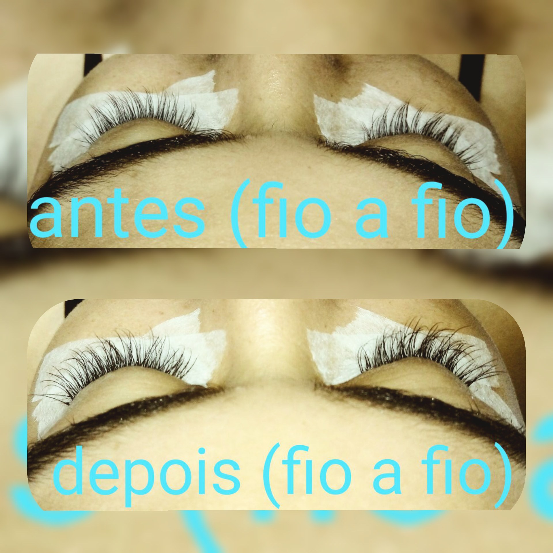 Alongamento fio a fio. (Ante e Depois). estética podólogo(a) manicure e pedicure