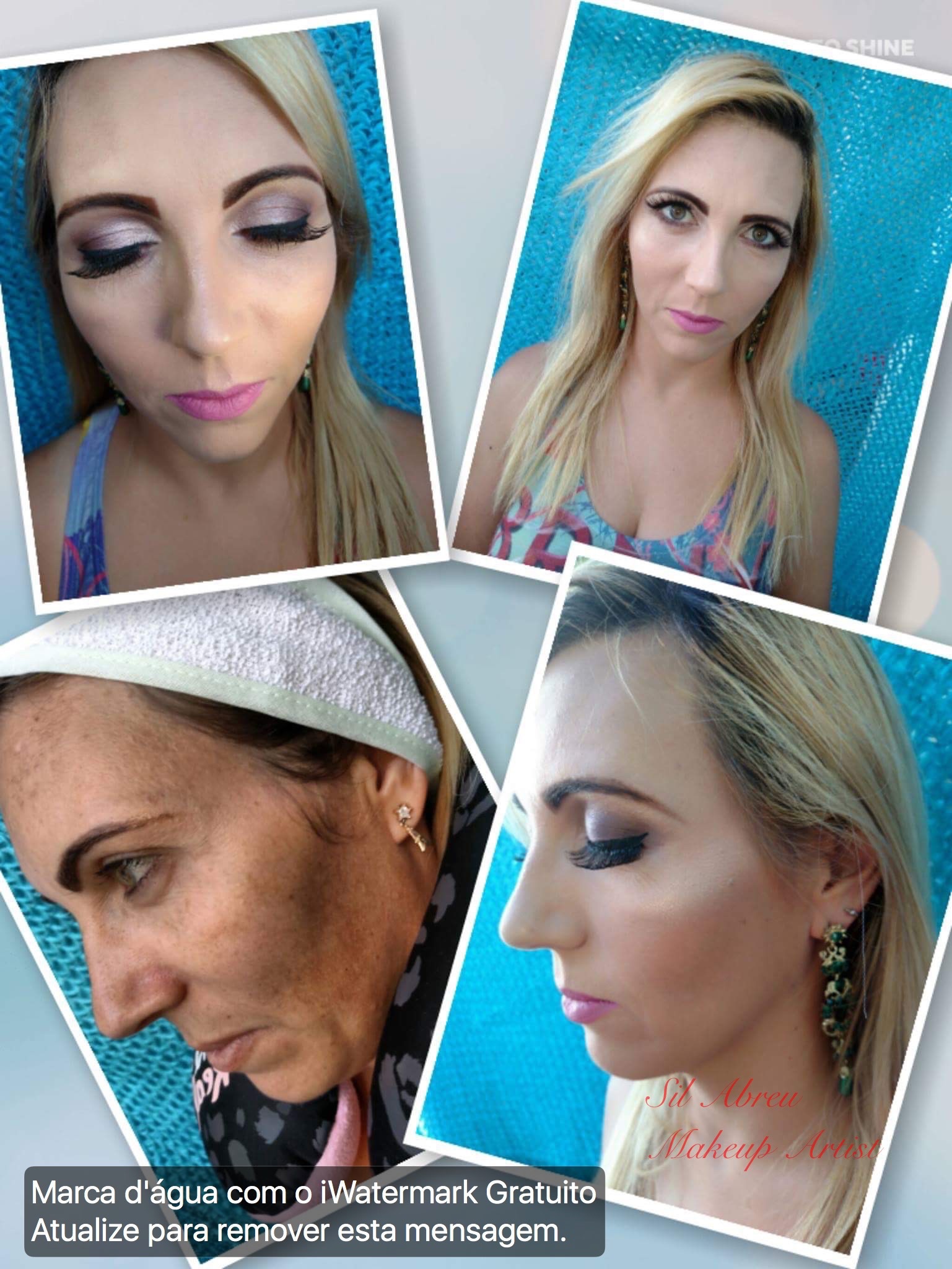 Camuflagem com produtos Kryolan em pele com imperfeição severa de melasma. maquiagem maquiador(a)