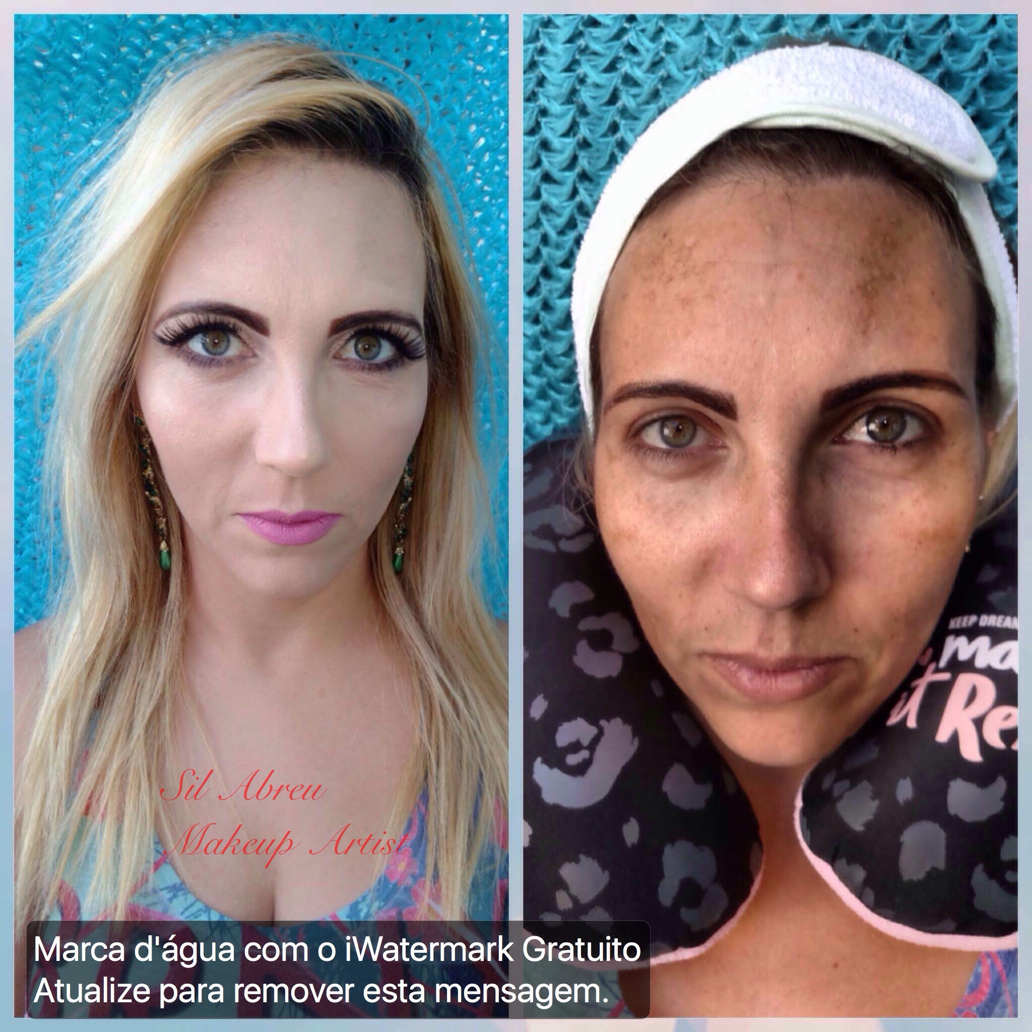 Camuflagem com produtos Kryolan em pele com imperfeição severa de melasma. maquiagem maquiador(a)