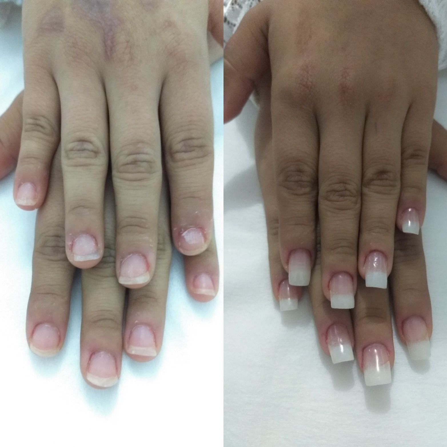 Alongamento em Acrigel ❤ unha manicure e pedicure manicure e pedicure