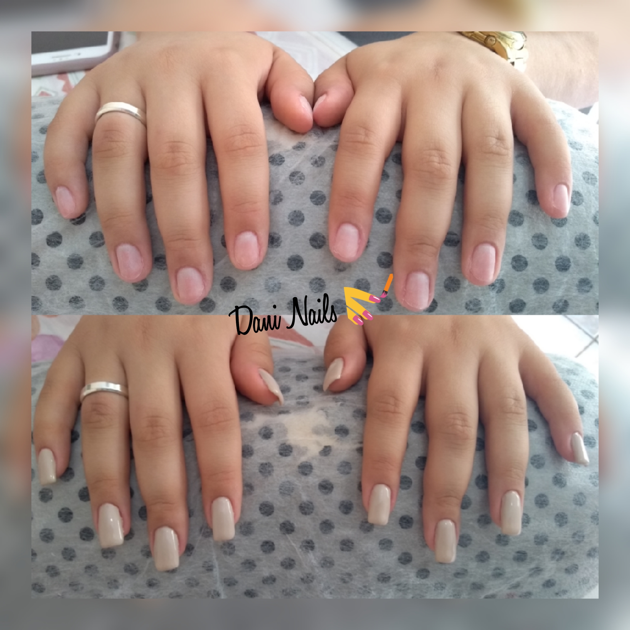 Alongamento de unhas em gel, antes e depois. unha manicure e pedicure
