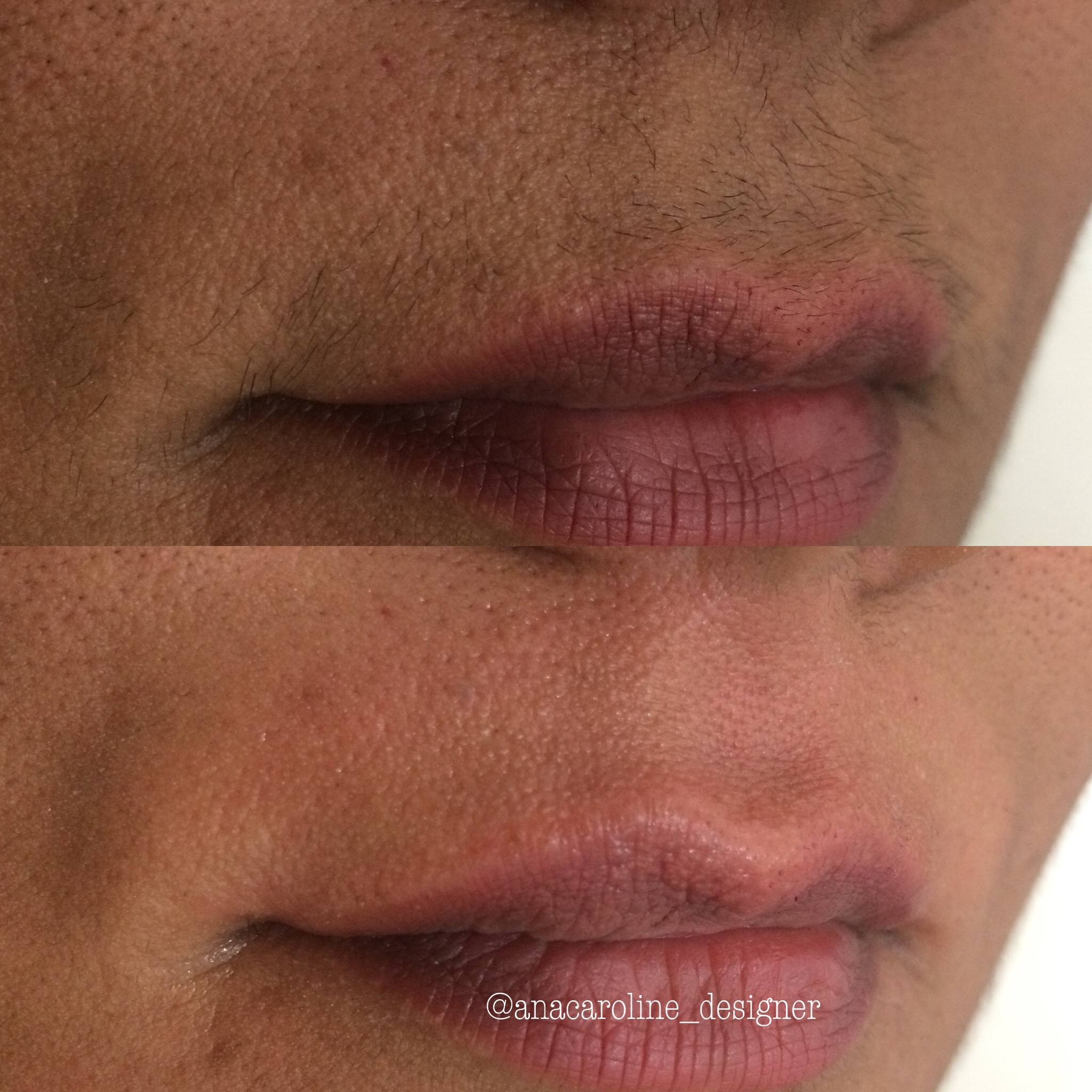 Depilação Facial - Buço outros designer de sobrancelhas micropigmentador(a) maquiador(a)