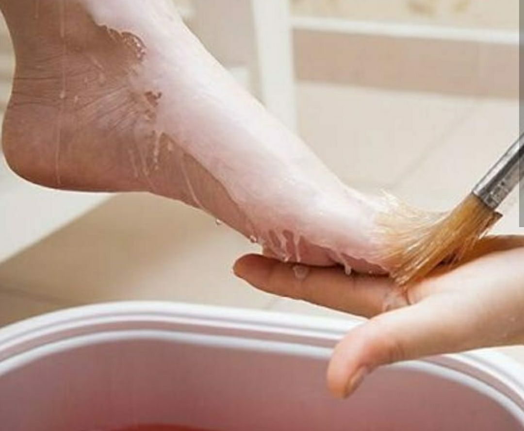 O frio chegou e, com ele, os danos causados pelo frio e pela falta de umidade.Os pés tendem a ficar escondidos em sapatos fechados e botas, sofrendo com ressecamento e acúmulo de células mortas. Para revitalizá-los, nada melhor do que um tratamento intensivo, com parafina,  a fim de remover nutrir e proteger a pele dos pés dos danos causados por constantes agressões externas. podólogo(a)