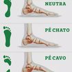 Qual o seu tipo de pisada? 👣👣 É extremamente importante, que saibamos qual o nosso tipo de pisada, assim, conseguimos escolher: 🔹O melhor calçado (evitando dores)
🔹Ajustar e andar corretamente
🔹Usar Palmilhas adequadas para o tipo de pé

E aí, qual a sua pisada? 👣👣 🔹Neutra - O pé encontra-se com o chão de forma uniforme, sem sobrecarregar nenhum ponto
🔹Pé Chato - O pé toca o chão quase que por inteiro, fazendo com que a parte do dedão do pé receba mais impacto, trazendo a pisada "para dentro"
🔹Pé Cavo - O pé fica no formato de "arco" deixando os dedos e o calcanhar tocando no chão. Pode causar dor e supinação (pisada "para fora")