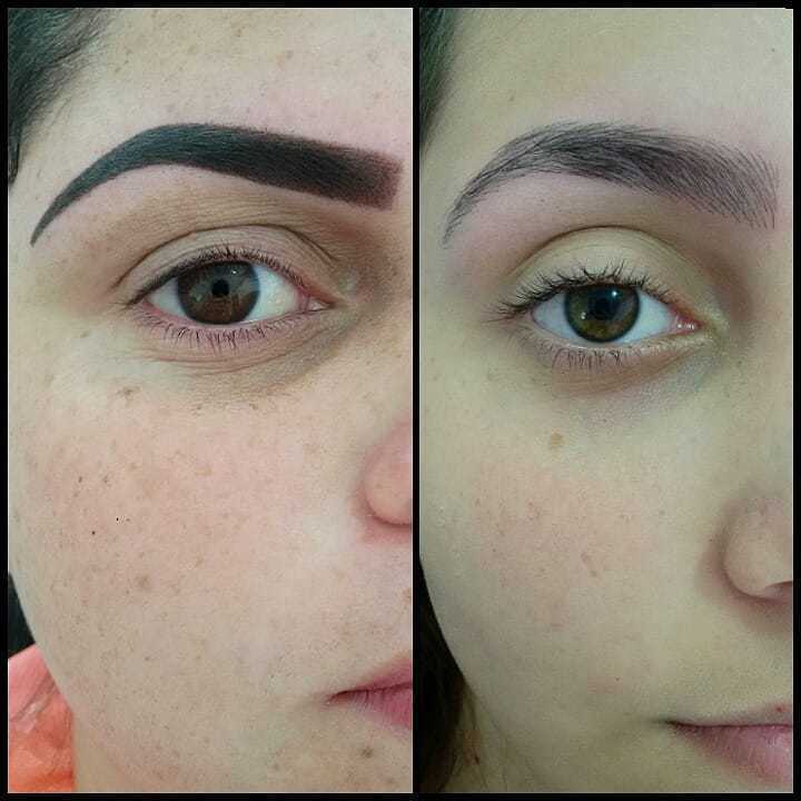 OMBRE × FIO A FIO
(fotos logo após)
________________________________
Ombre:
• Indicada para quem gosta das sobrancelhas marcadas
• Efeito make/ henna
• Fica melhor em quem já tem uma quantidade de pelos considerável
________________________________
Fio a fio:
• Indicada para quem quer resultado mais natural
• Efeito pelinho
• Fica lindo tendo muito ou poucos pelos
• Pode fazer outras técnicas por cima posteriormente estética dermopigmentador(a) designer de sobrancelhas biomédico(a) maquiador(a) outros