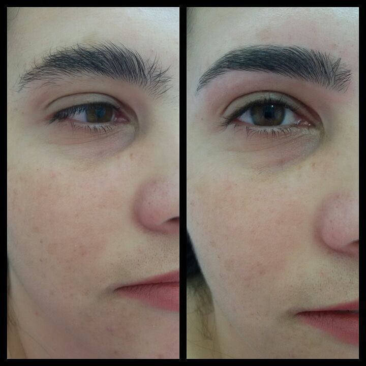 Design de sobrancelhas. 
Antes e depois.
 estética dermopigmentador(a) designer de sobrancelhas biomédico(a) maquiador(a) outros