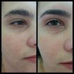 Design de sobrancelhas. 
Antes e depois.
