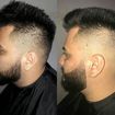 Antes e depois barba e cabelo