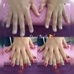 Alongamento em gel.
