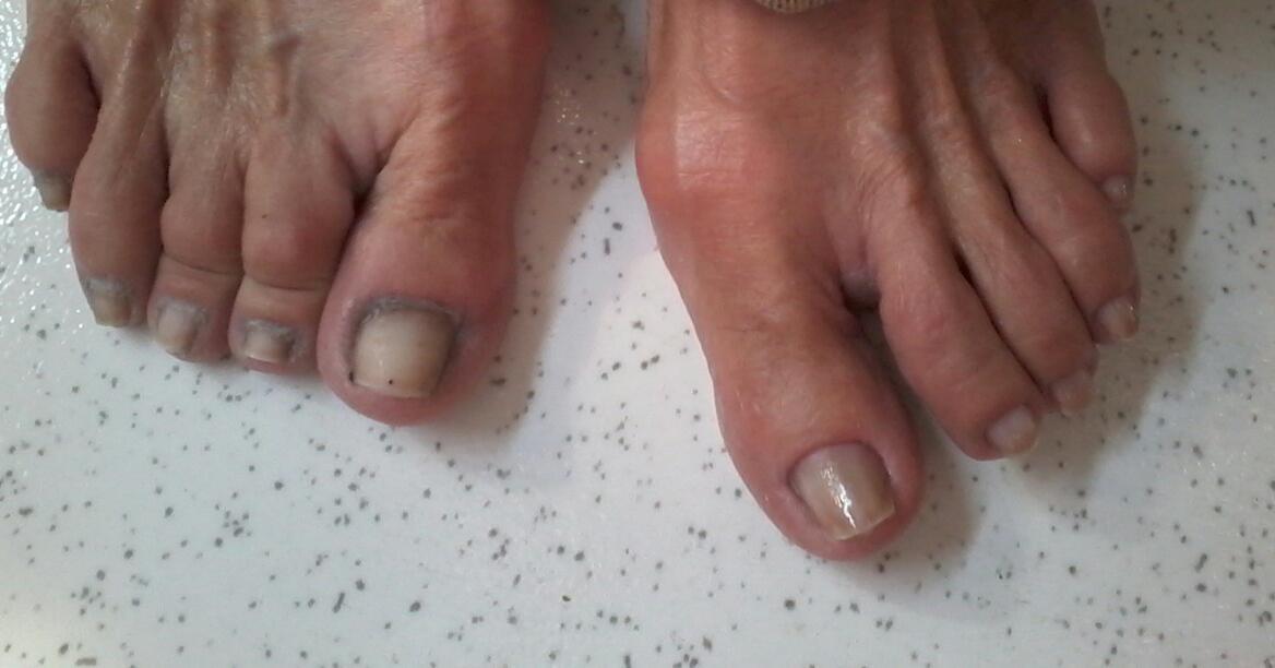 Antes e depois!  😉 unha manicure e pedicure consultor(a)