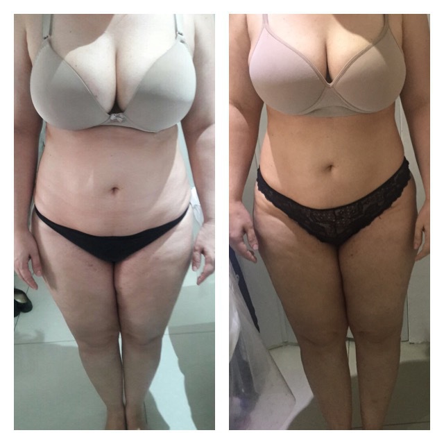 Redux Detox, 15 Sessões. estética esteticista