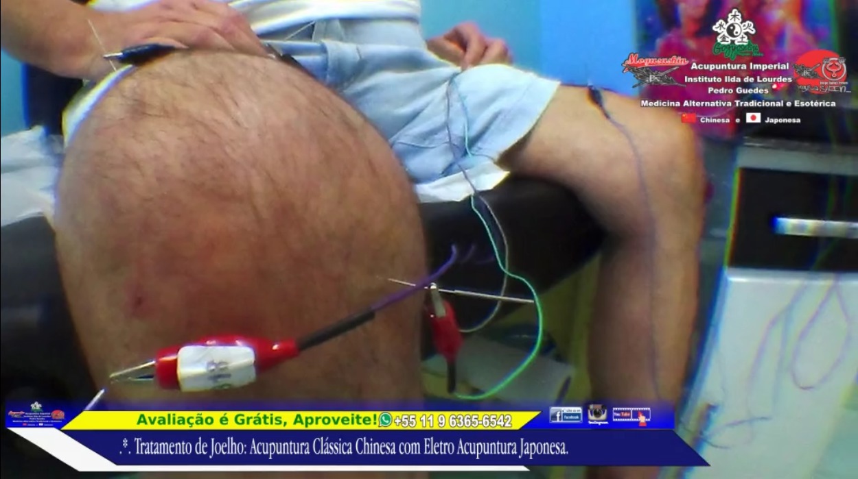 .*. Tratamento de Joelhos Acupuntura Clássica Chinesa e Eletro-Acupuntura Japonesa. outros acupunturista docente / professor(a)