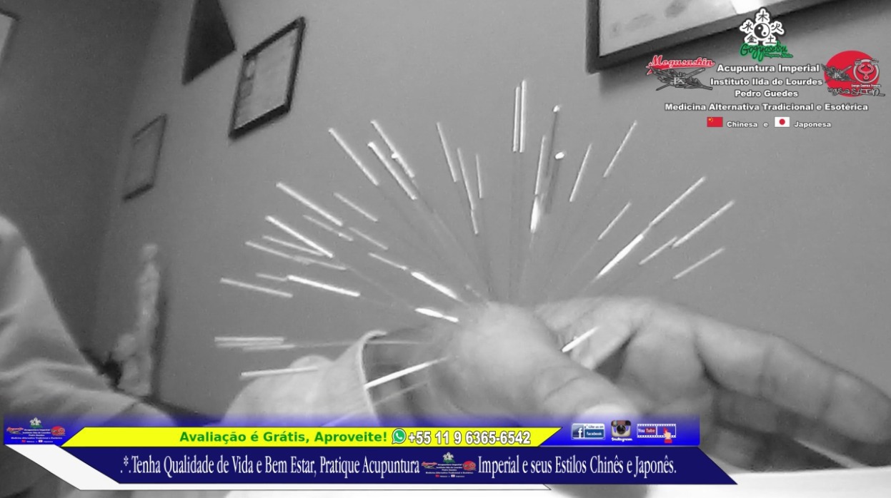 .*. Tratamento de 1º metacarpo e 1º Falange Proximal do Polegar. Acupuntura Clássica Chinesa.  outros acupunturista docente / professor(a)