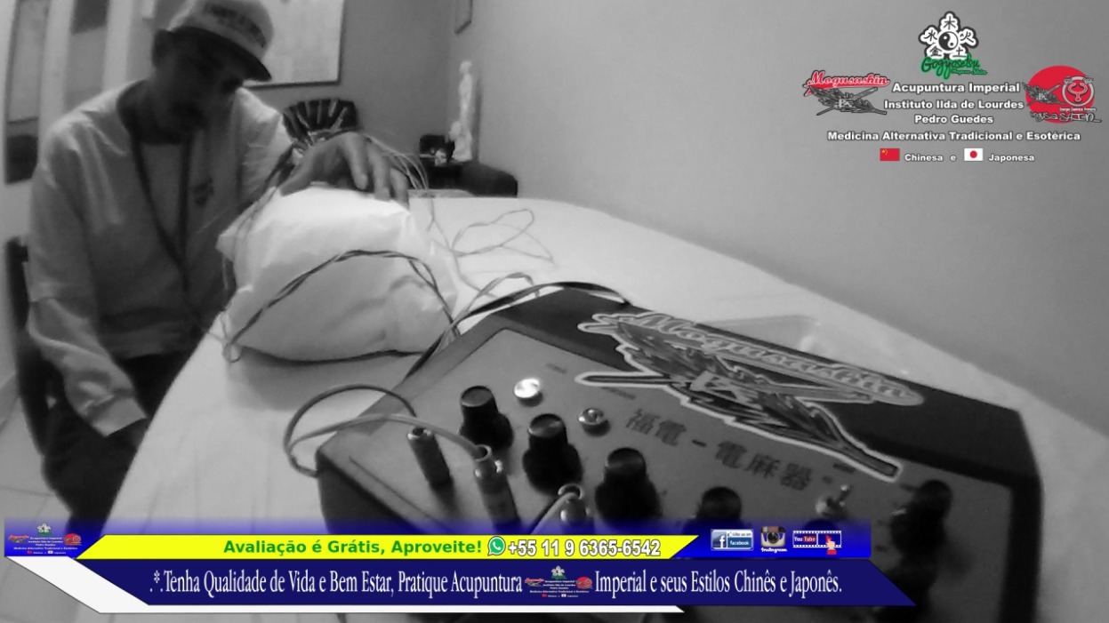 .*. Tratamento de 1º metacarpo e 1º Falange Proximal do Polegar. Acupuntura Clássica Chinesa.  junto com Eletro-Acupuntura Japonesa. outros acupunturista docente / professor(a)