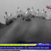 Tratamento de Lombar e Nervo Ciático Acupuntura Clássica Chinesa, Eletro Acupuntura Japonesa e Ventosa-Terapia. 