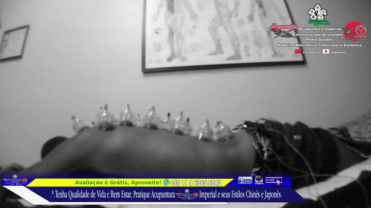  Tratamento de Lombar e Nervo Ciático Acupuntura Clássica Chinesa, Eletro Acupuntura Japonesa e Ventosa-Terapia.  outros acupunturista docente / professor(a)
