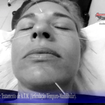 .*. Tratamento de Bruxismo, A.T.M (Articulação Têmporo-Mandibular) e Nervo Trigêmeo (Ramos Temporal, Zigomático e Mandibular), Acupuntura Clássica Chinesa e Acupuntura para Rejuvenescimento Facial.