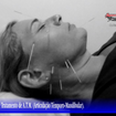 .*. Tratamento de Bruxismo, A.T.M (Articulação Têmporo-Mandibular) e Nervo Trigêmeo (Ramos Temporal, Zigomático e Mandibular), Acupuntura Clássica Chinesa e Acupuntura para Rejuvenescimento Facial.