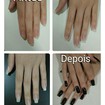 Alongamento de unhas Acrigel.