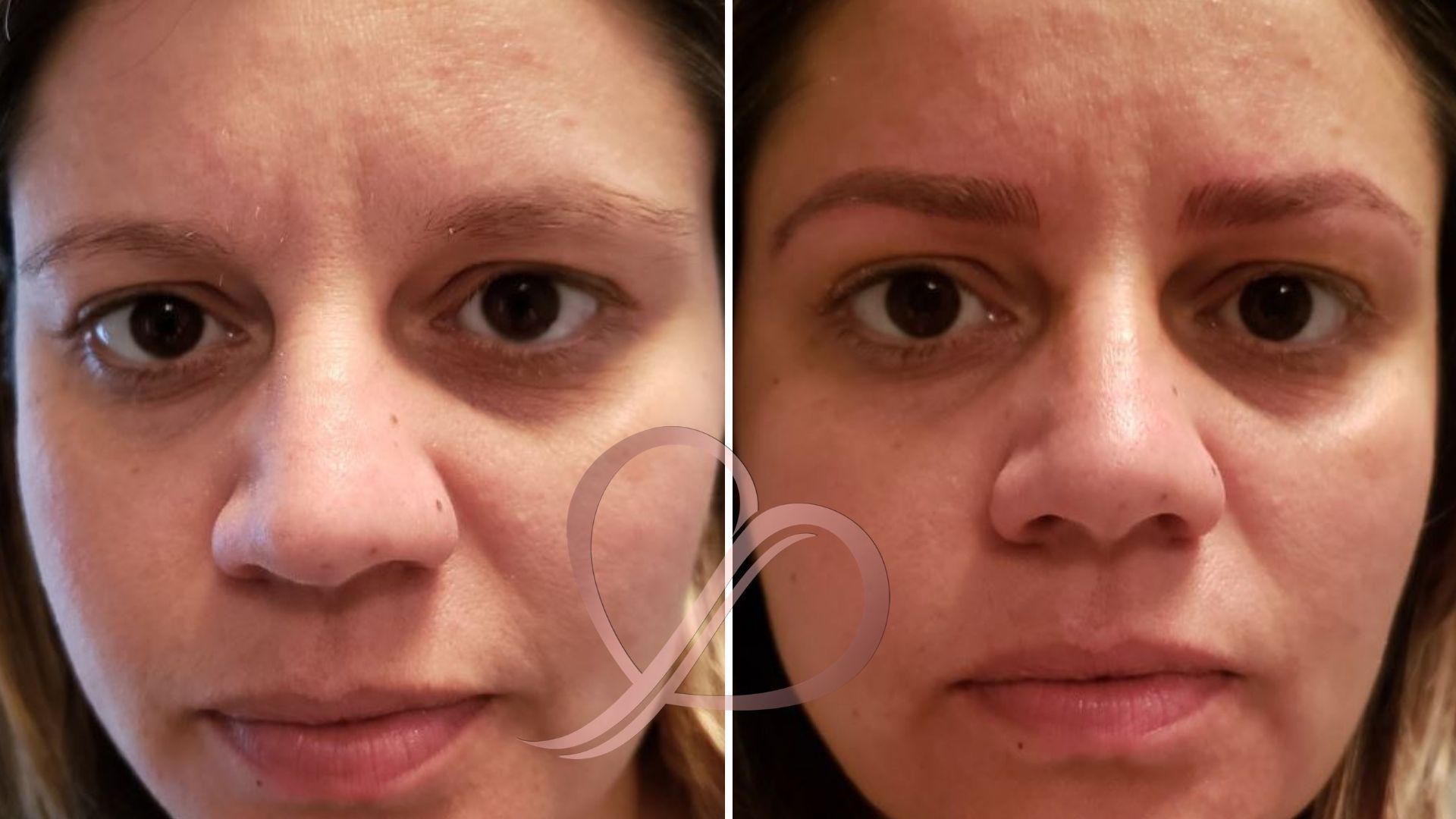Microblading outros esteticista micropigmentador(a)