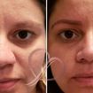 Microblading