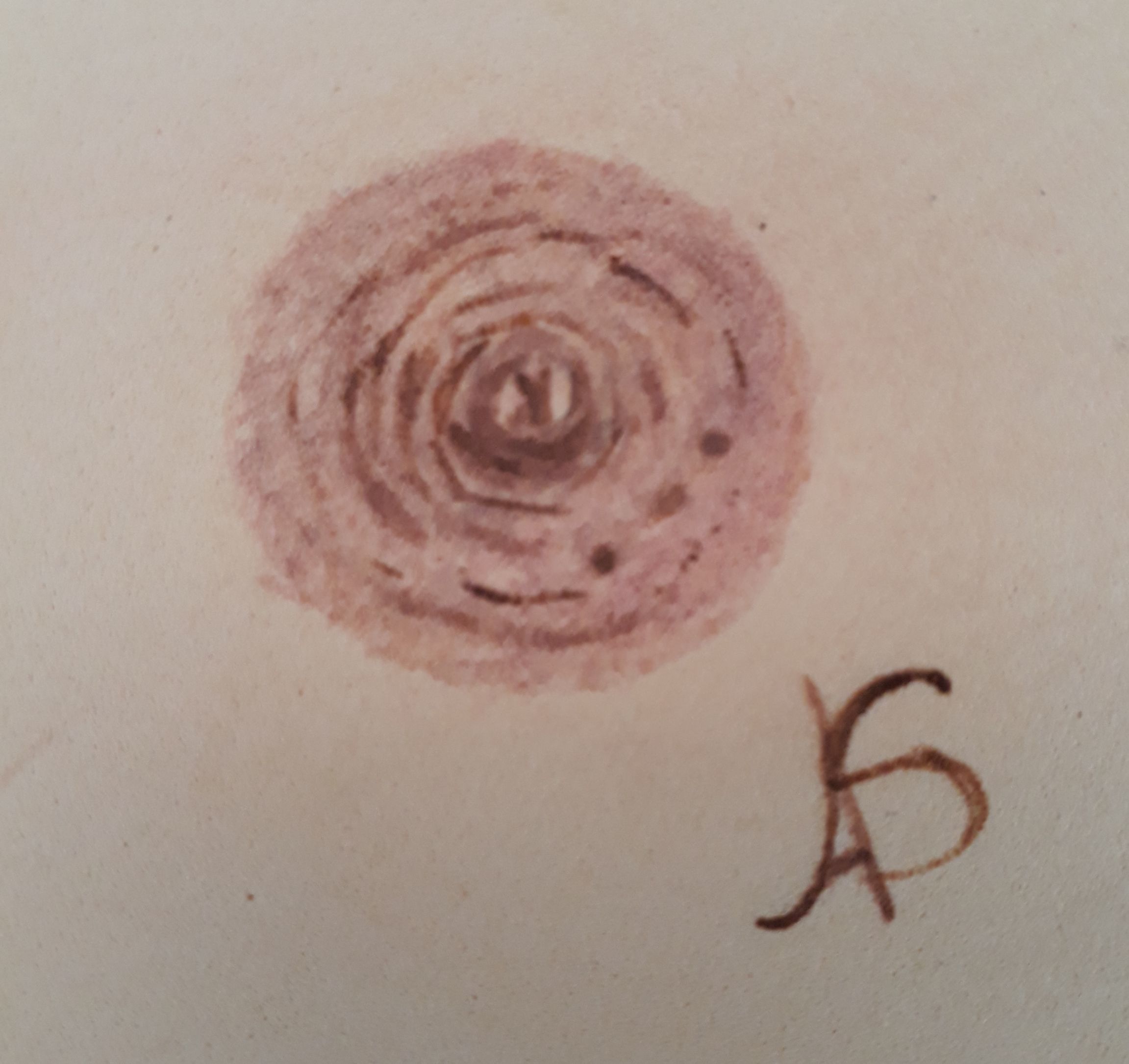 Reconstrução areola mamária #Paramedica #belezasemidade #areola outros esteticista dermopigmentador(a) designer de sobrancelhas micropigmentador(a)