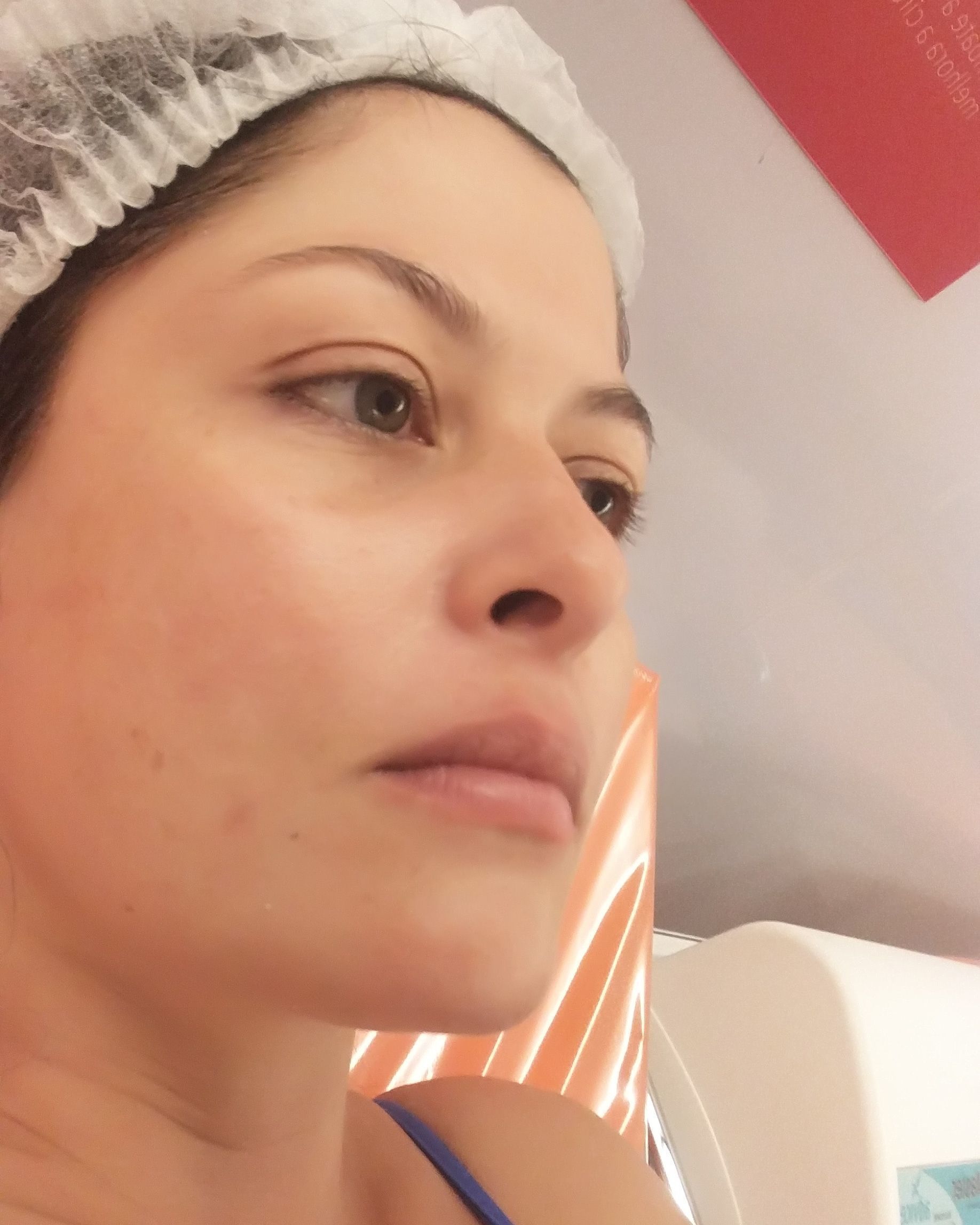 Detox Facial com Vitamina C e Led #detoxfacial #colageno #limpezadepele outros esteticista dermopigmentador(a) designer de sobrancelhas micropigmentador(a)