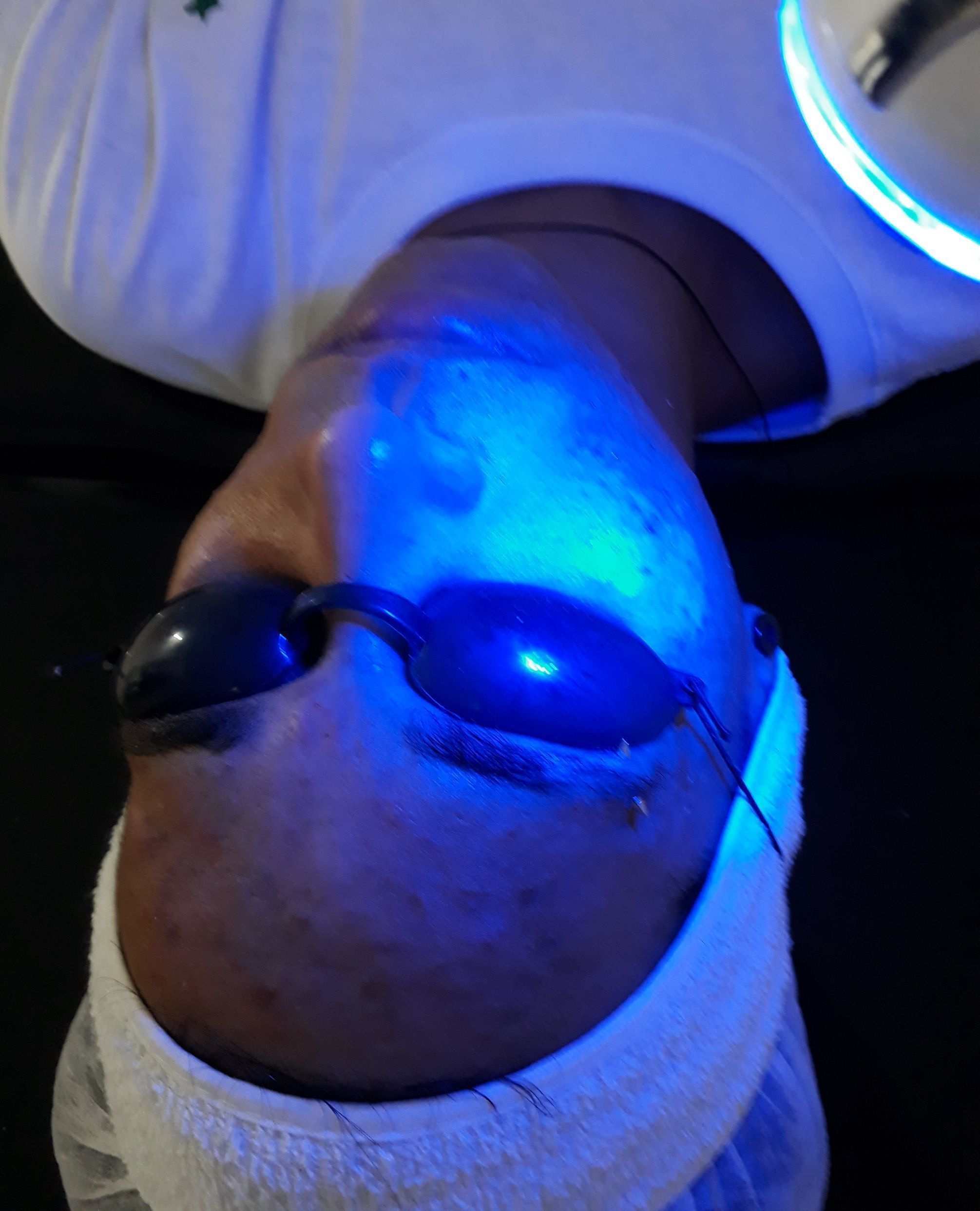 Limpeza de Pele masculina! Tratamento anti acnes
#limpezadepele #jatodeplasma #eletrocauterio #belezasemidade outros esteticista dermopigmentador(a) designer de sobrancelhas micropigmentador(a)