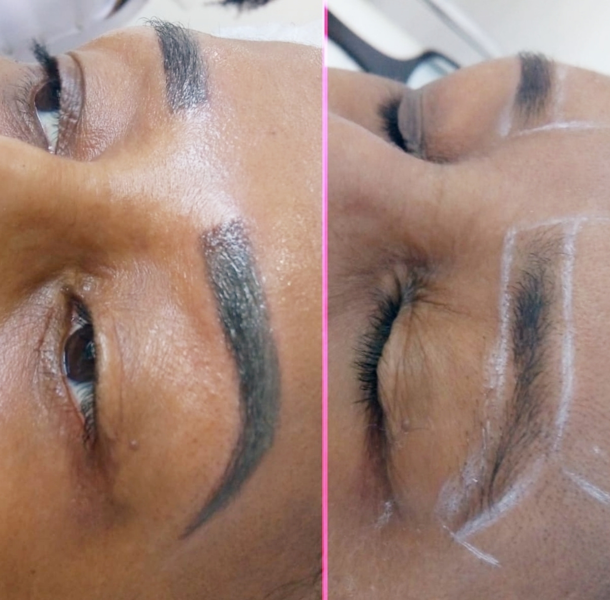 Micropigmentação Peles Negras
Antes• Desgin ainda não feito
Depois• Procedimento Finalizado  estética designer de sobrancelhas
