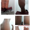Tratamento de profilaxia e higienização dos pés.
