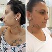 Vamos aprender os pontos da drenagem linfática facial??? Atividade em dulpa !!
