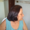 Botox 