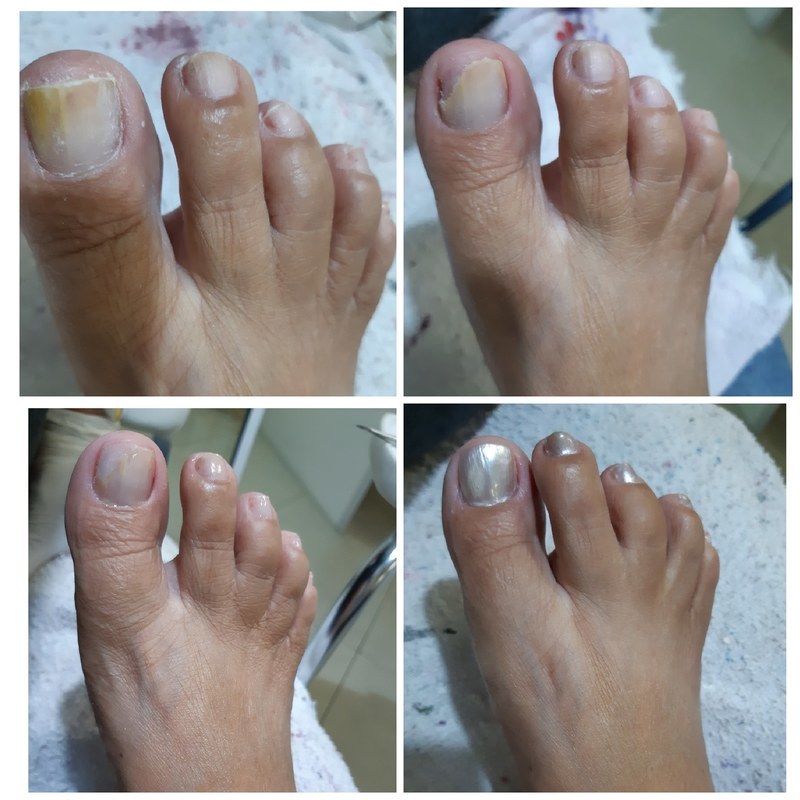 Reconstrução da unha . unha manicure e pedicure