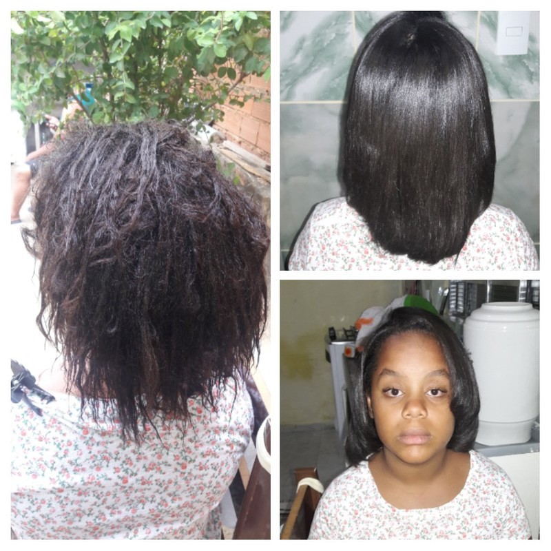 Botox de Ácido Hialurônico  cabelo cabeleireiro(a) auxiliar cabeleireiro(a)
