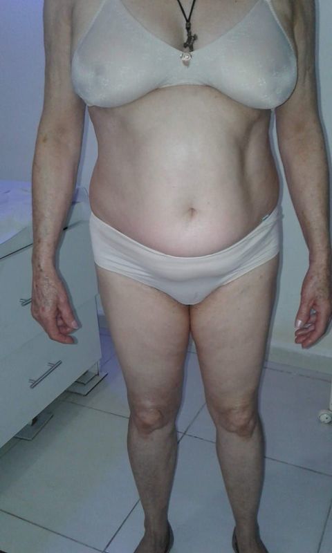 Massagem Redutora estética massoterapeuta esteticista aromaterapeuta