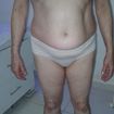 Massagem Redutora