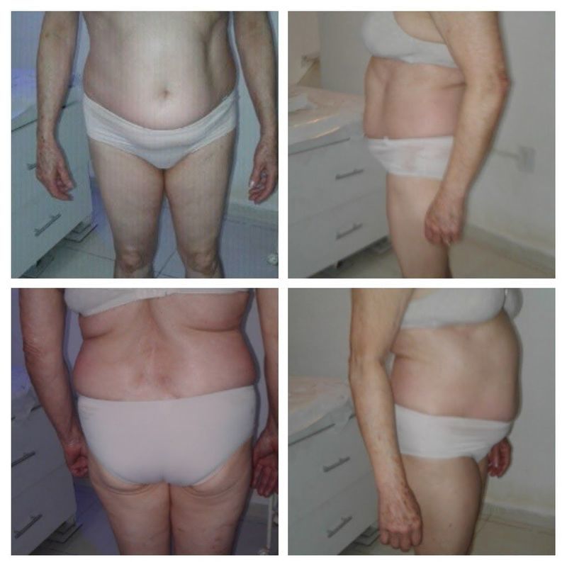 Massagem Redutora estética massoterapeuta esteticista aromaterapeuta