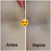 Linha intimate clay da Medicatriz!! Linha de clareamento de face corpo e região íntima! Com ativos clareadores como Bio AHAS, extrato de uva Ursi, argila branca, extrato de Ferola Foetida. Composições que inibem a produção de melanina, combatem os radicais livres, inibem a tirosinase.