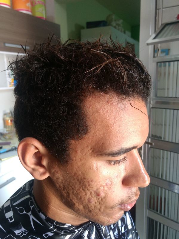 Antes do corte e progressiva!! barbeiro(a) cabeleireiro(a)