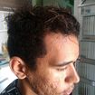 Antes do corte e progressiva!!