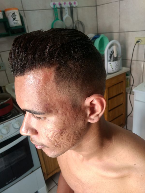 Depois do corte e progressiva!! barbeiro(a) cabeleireiro(a)