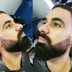 Barba degredê.