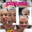 Tratamento de melasma