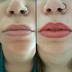 Micropigmentação labial - antes e logo após - resultado clareia cerca de 50%, ficando bem natural