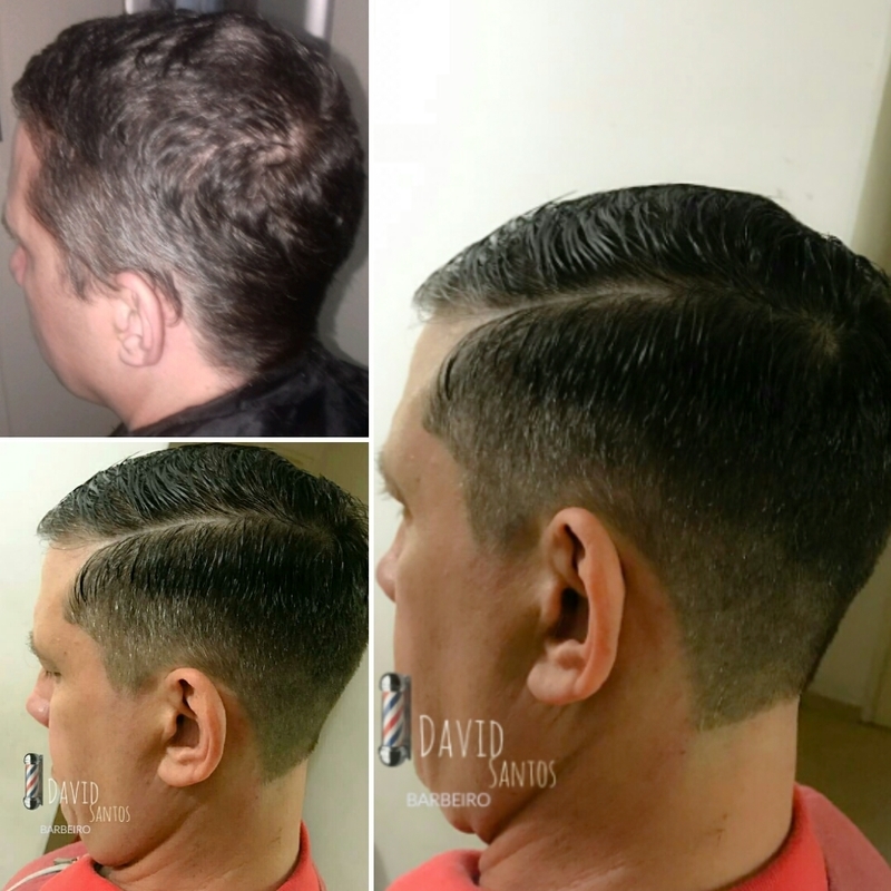 (Antes e Depois) Corte RAZOR PART.  💈✂
#Barbeiro  cabelo barbeiro(a)