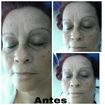 ANTES :Pele madura com melisma , olheiras profundas e sobrancelhas finas.