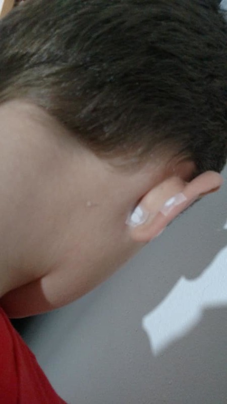 auriculoterapia com stiper  outros massoterapeuta aromaterapeuta quiropraxista acupunturista outros