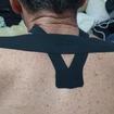Bandagem elástica no trapézio (dor)